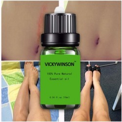 Narbenentfernung & Aknebehandlung - Lavendel Massageöl 10 ml