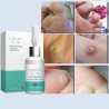 Mole Skin Tag Repair Solution Painless Mole Skin Dark Spot Repair Face Wart Tag Freckle Repair Cre
