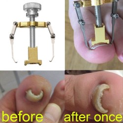 Professional ingrown toenail corrector - lifter - stainless steelEquipment