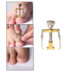 Professioneller Ingrown-Toenail Korrektor - Aufzug - Edelstahl