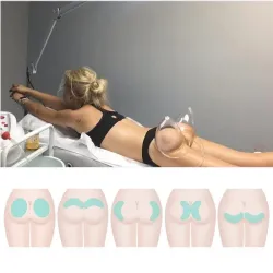 Creoy Vacuum Massage Therapy Machine Breast Enlargement Pump Lifting Enhancer Massager Cup And Body