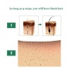 3 pieces - hair growth liquid - ginger essence - 7 days treatmentHair