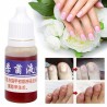 Chinesische Medizin - Nagelreparatur bei Onychomykose - Nagelpilz - 10 ml