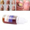 Chinesische Medizin - Nagelreparatur bei Onychomykose - Nagelpilz - 10 ml