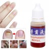 Chinesische Medizin - Nagelreparatur bei Onychomykose - Nagelpilz - 10 ml