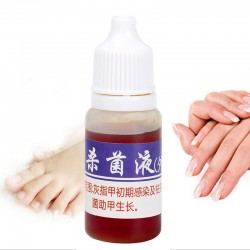 Chinesische Medizin - Nagelreparatur bei Onychomykose - Nagelpilz - 10 ml