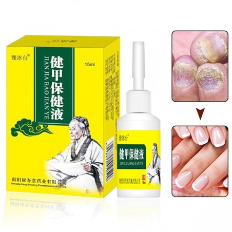 15ml - Nagelpilzbehandlung - Entfernung - Nagelreparaturflüssigkeit