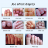 15ml - Nagelpilzbehandlung - Entfernung - Nagelreparaturflüssigkeit