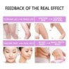 Slimming spray - fat burner - anti-cellulite - firming - 30mlMassage