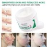 Narbenentfernungscreme - Dehnungsstreifen - Aknenarben - Gesichts-/Körperbehandlung - 50 ml