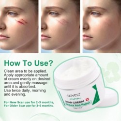 Scar removal cream - stretch marks - acne marks - face / body treatment - 50 mlSkin