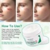 Scar removal cream - stretch marks - acne marks - face / body treatment - 50 mlSkin