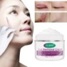 Narbenentfernungscreme - Dehnungsstreifen - Aknenarben - Gesichts-/Körperbehandlung - 50 ml
