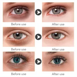 Brightening eye serum - Vitamin CSkin