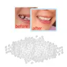 Temporary teeth repair kit - gaps filler - denture glueTeeth Whitening