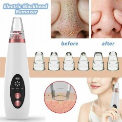 Blackheads / acne remover - face pores cleaner - vacuum suction face care - USBSkin