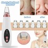 Blackheads / acne remover - face pores cleaner - vacuum suction face care - USBSkin