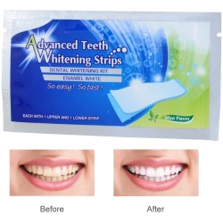 Professional teeth whitening - bleaching gel strips - 28 piecesMouth