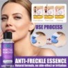 Hautflecken- / Warzenentferner - dunkle Flecken / Sommersprossen - flüssig - 30 ml