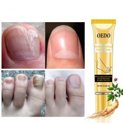 Nagelpilzbehandlung - Hand- / Fuß- / Nagelcreme - Ginseng - 15 gr