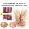 Nagelpilzbehandlung - Hand- / Fuß- / Nagelcreme - Ginseng - 15 gr