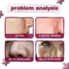 Gesichtsserum - Fruchtsäureessenz - AHA - BHA - Aknebehandlung - Aufhellung - 30ml