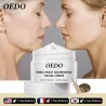 Snail extract face cream - collagen - hyaluronic acid - anti-wrinkle / whitening / moisturizingSkin
