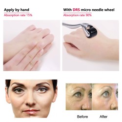 Dermaroller – Micro Needling – Titannadel – für Gesicht/Hals