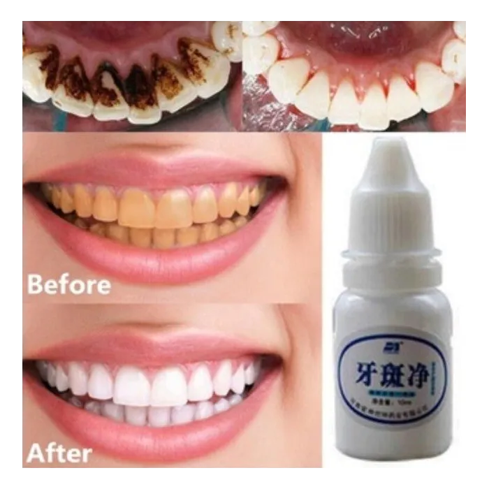 Teeth whitening water 10 mlMouth