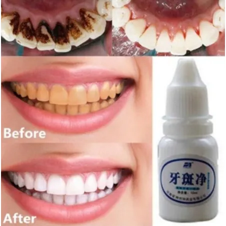 Teeth whitening water 10 mlMouth