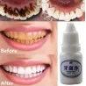 Teeth whitening water 10 mlMouth