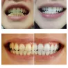 Teeth whitening water 10 mlMouth