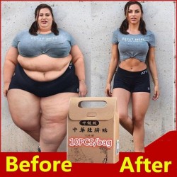 Slimming navel Aufkleber verlieren Gewicht Fettverbrennung Patches 10 Stück