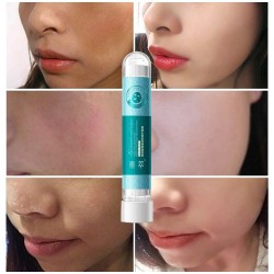 Akne-Behandlung - Blackhead-Entferner - Aufhellungsmaske mit Hyaluronsäure Schnecken Essenz 10 Stück